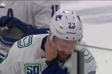 Alex Edler Cut In The Ear By Jordan Kyrou's Skate(Dual-Feed)