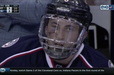 Blue Jackets' Zach Werenski returns to playoff game with black eye, face shield