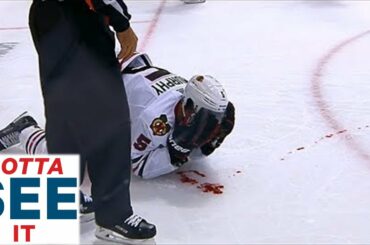 GOTTA SEE IT: Blackhawks' Murphy Bloodied By Pitlick Elbow To Face