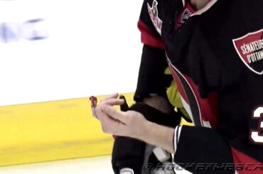 Sidney Crosby Shatters Marc Methot's Finger (Close-Up) - WARNING: Graphic Images (HD)