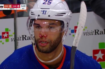 Darnell Nurse Struck By A Puck In The Face After Puck Bounced Off The Crossbar And Hit Him