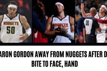 Aaron Gordon away from Nuggets after dog bite to face hand | NY Sports News