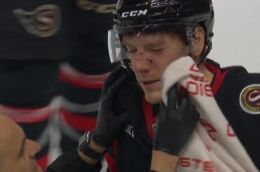 Parker Kelly Hit In The Face By Puck