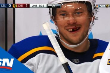 Blues' Vladimir Tarasenko All Smiles After Retrieving Lost Tooth